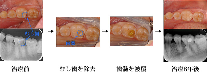 臨床症例