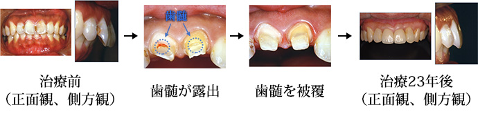 臨床症例